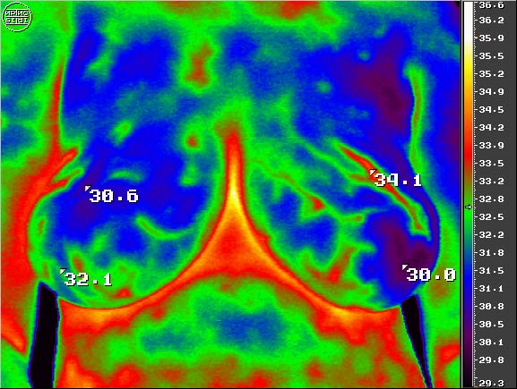 download nanoporous metals for