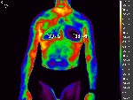 Ischemia disease  of  heart